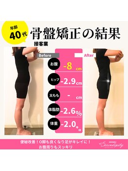 セレンディピティ 稲沢店(serendipity)/骨盤矯正整体×ダイエット