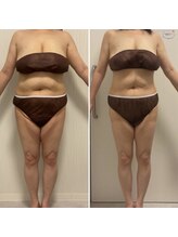 ラクシュミー/ビフォーアフター