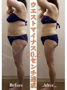 エアリアル 武雄店/エアリアルの痩身メニュー