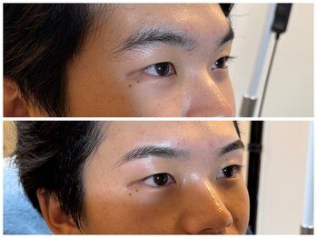 スリーピース(3Peace)/アーチ眉 Before/After