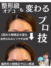 顔凛(カオリン)/オデコも変わる小顔矯正