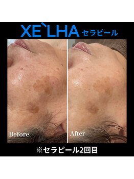 シュ シュ(chou chou)/【セラピール】