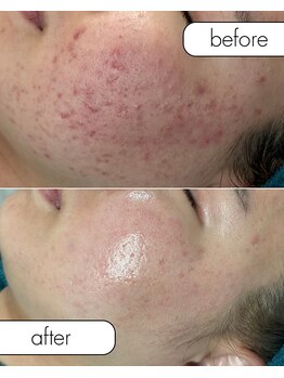 リノルーア(Linolua)/