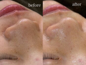 テオリア(TEORIA)/