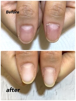 モアニヒロオ 広尾駅前店(MOANI Hiroo)/【深爪育成】爪伸びてます☆