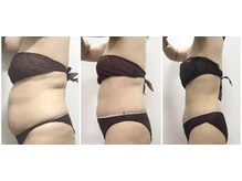 ビューティーワークスシャンティ 柏店(Beauty Works Shanti)/お客様の成果☆before after