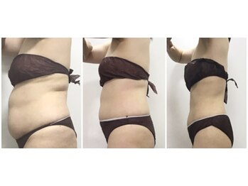 ビューティーワークスシャンティ 柏店(Beauty Works Shanti)/お客様の成果☆before after