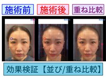 セブンシーズ 上野店(Seven Seas)/【フェイシャル】美顔形成[上野]