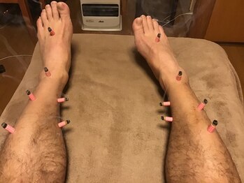 ライズ/Moxa to leg