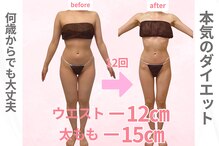 イロイロ(ILO ilo)