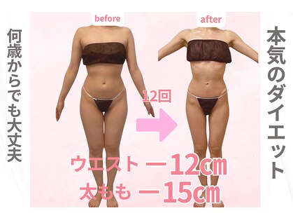 イロイロ(ILO ilo)の写真