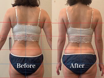 ジェイオー(J.O)/育乳コルギ/小顔コルギ