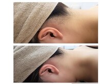 イクヨノ ビューティーサロン(194's beauty salon)の雰囲気（ブライダルシェービング（電気シェーバー使用））