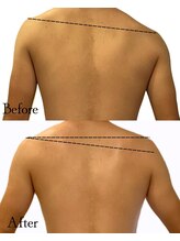 ロイヤルキューティー 介正鍼灸整骨院 コマーシャルモール博多(ROYAL QT)/リンパドレナージュ90分