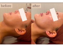 エステ ココ 荻窪店(Esthe CoCo)/美肌/肌管理/毛穴