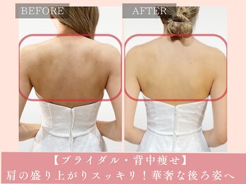 サロン ド リアン(salon de lien)/肩甲骨を整えて美しい後ろ姿へ★