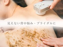 ルナティアラ(LUNAティアラ)の雰囲気（ブライダルにもオススメ♪【ハーブピーリング/毛穴洗浄/リンパ】）