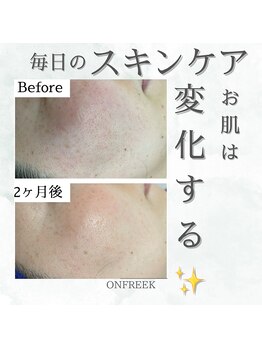 オンフリーク(ONFREEK)/リアボーテ化粧品