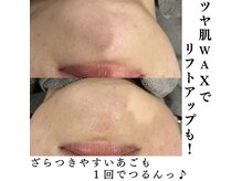 リライズ 磐田(Rerise)/ツヤ肌 WAX脱毛