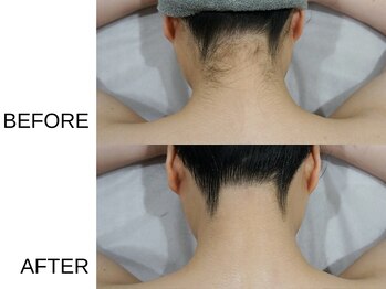 アニュ(a nu)/ブライダル・成人式にも!