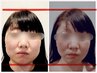ビフォアフ写真掲載OK