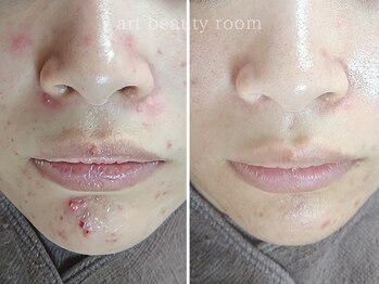 アート ビューティールーム(art beauty room)/☆オーダーメイド