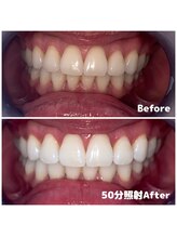 ライトビューティー 関内店(LIGHT BEAUTY)/［ 1day完結プラン ]