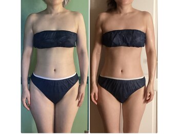 きれい 渋谷恵比寿店/Before/After