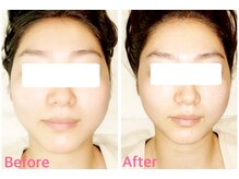 エム 銀座(M)の雰囲気（神業！小顔最高峰技術！ハーブピーリング/ハーブピーリング小顔）