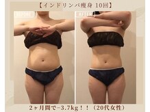 オキシー グレイス 黒崎店(OXY Grace)/インドリンパ痩身×キャビ