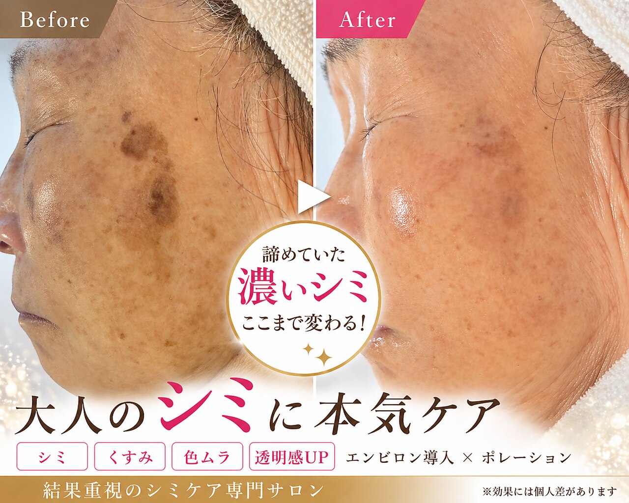 サラシック(salachic)｜ホットペッパービューティー