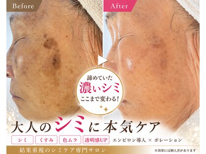 サラシック(salachic)の写真