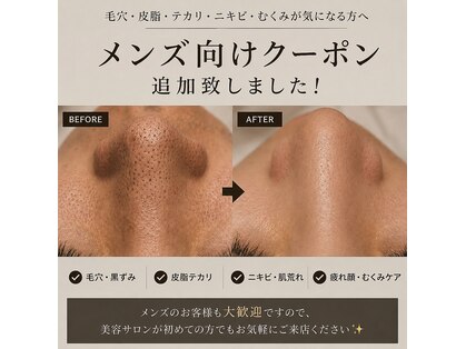 ビジュー(Bijou)の写真