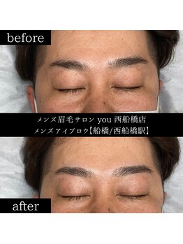 ユー 西船橋店(you)/ビフォーアフター写真