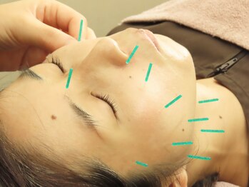 ポルクス鍼灸整骨院 表参道(Pollux鍼灸整骨院)/美容鍼灸 鍼灸マッサージ