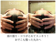 ライフチャージ(Life Charge)/ドライヘッドスパBefore→After