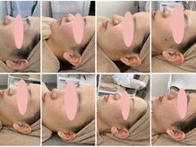 ロイ(Loy)の雰囲気（効果続々☆自信のなかった自分の肌が大好きに♪）