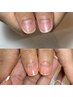 人気No.1 ネイルケア（ハンドケア）