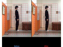 ゼロヒャク整骨院(ZERO100整骨院)/猫背矯正×骨盤矯正