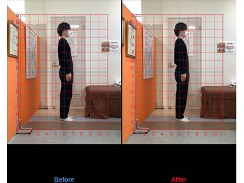 ゼロヒャク整骨院(ZERO100整骨院)/猫背矯正×骨盤矯正