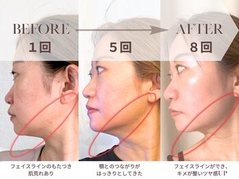 シャインアン(Shine'an)の写真/健康美容派の方必見!!美顔筋トレマシーンでリフトアップと肌質改善どちらも手に入れて♪