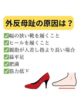 熊本カワル整体 JR上熊本駅院/足の親指の痛み