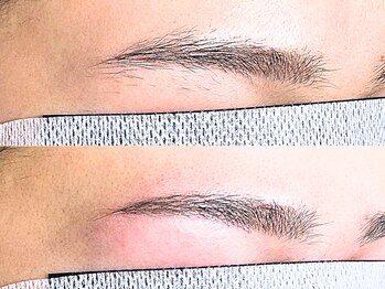 リムーブ(ReMove)の写真/「終わりのある脱毛」で理想の眉を手に入れよう!ムダ毛1本1本脱毛するReMoveの特別な技術です♪