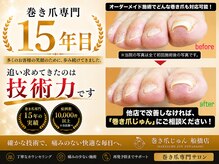 巻き爪じゅん 船橋店