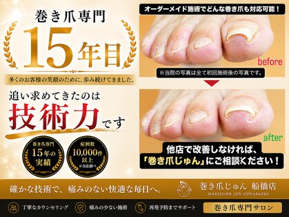 巻き爪じゅん 船橋店の写真