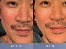 カズキ ハギワラ(Kazuki Hagiwara)の雰囲気（【ビフォアフ】イスラエル製のプロ用化粧品で、男の肌を仕立てる）