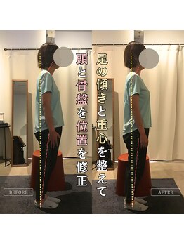 岡山整体 リソル(Resol)/姿勢改善ビフォーアフター