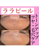 フルブルーム(Full Bloom)/ララピール 