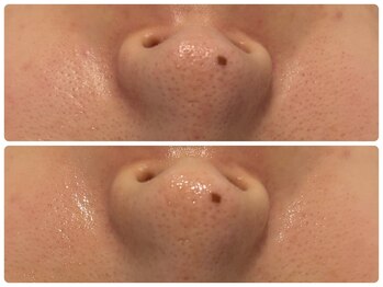 エフェクト 塚口店(effect)/Before After