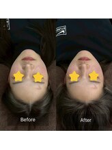 トニック バイ まつもと整骨院鍼灸院(Tonic)/★Before After★豊中／小顔